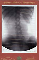 Caesar Comas & Agust� Pri� - Large X-Ray of a Woman