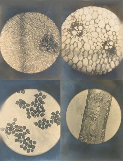 Photo Detail - Anonymous - Eight Microscopic Views Photo Detail - Anonymous - Eight Microscopic Views